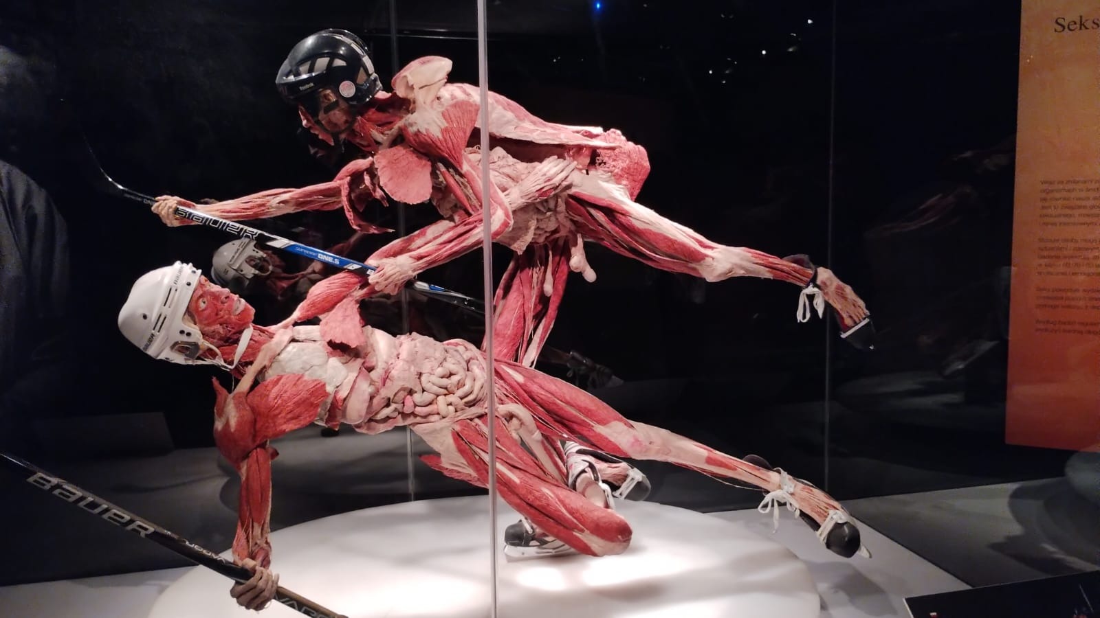 " Body Worlds & The Cycle of Life" - Obrazek 5